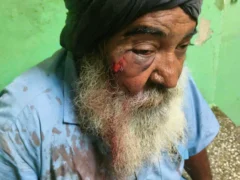 लखीमपुर खीरी: घर में झांकने के आरोप पर पिता‑पुत्र पर पिटाई, बुज़ुर्ग का सिर फट गया